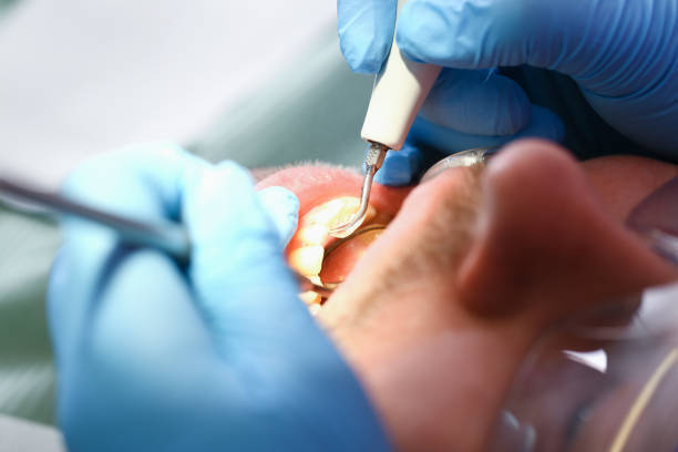 Best Emergency Treatment for Dental Infections or Abscesses in Larned, KS
